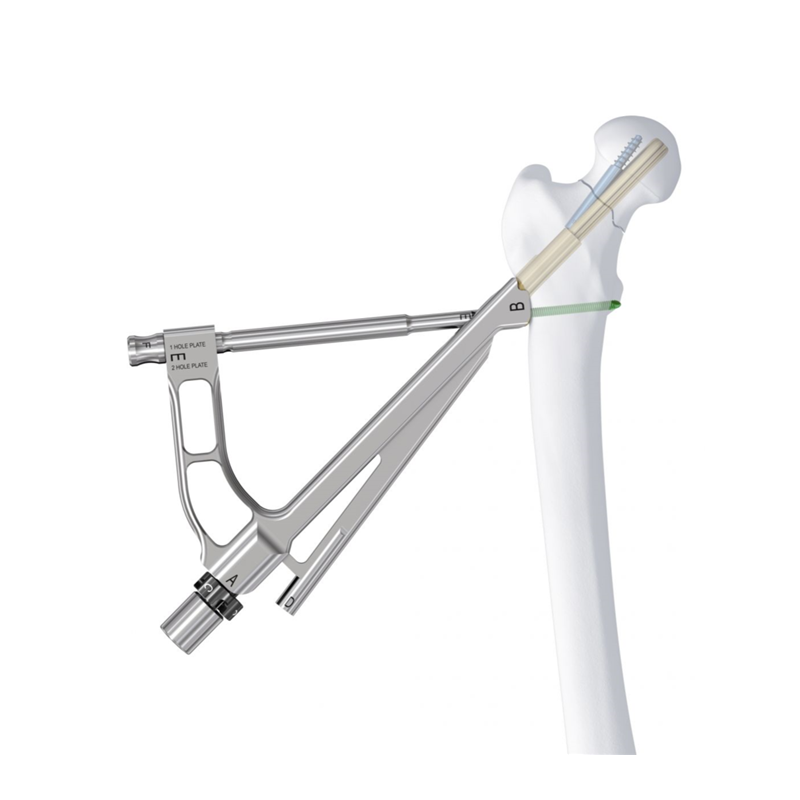 FNS (Sistema de cuello femoral)