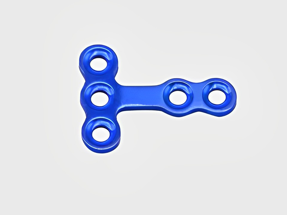  Placa de bloqueo maxilofacial de 1,5 mm